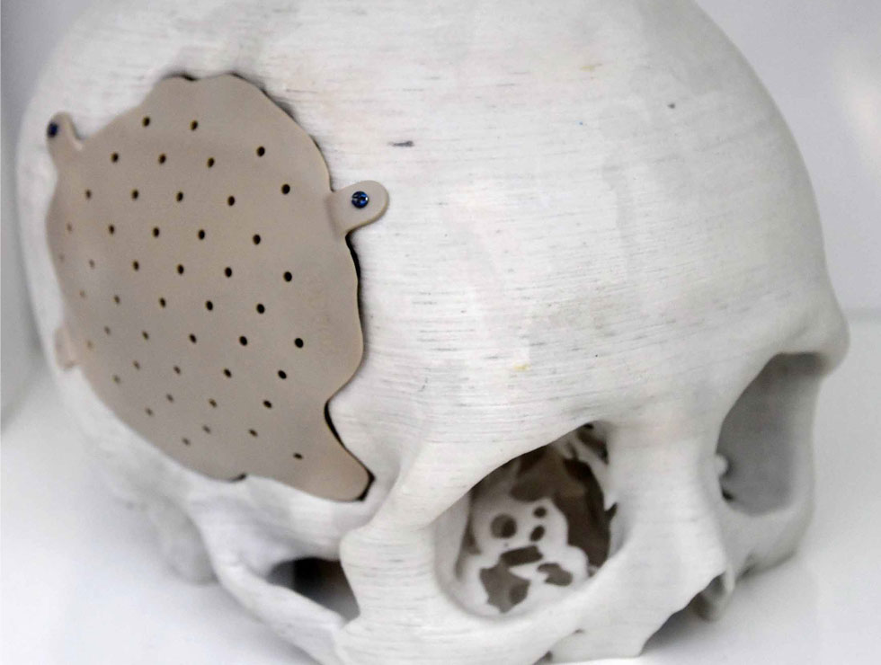 �@������ɫ�ĸ�ˎ��������Ŀ��������3D��ӡ���XĤ��